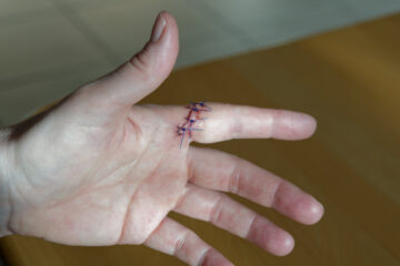 Matthias - Challenge 152: Kaputt - 02.03 - 15.05.2026 - Noch dran